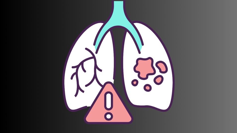 1: Respiratory Issue
